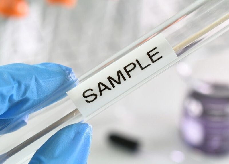 STD testing