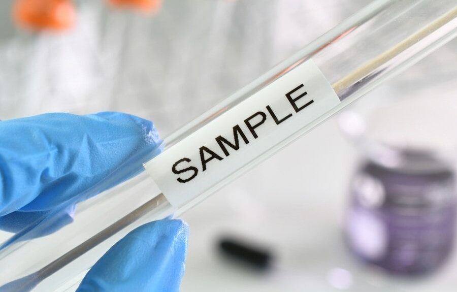 STD testing