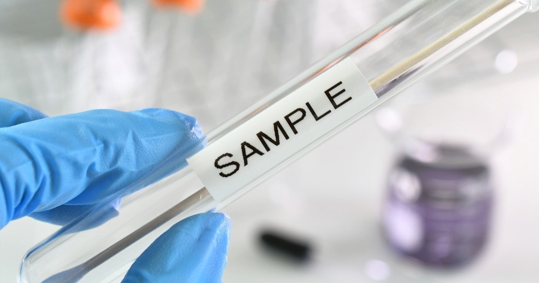 WHAT TO EXPECT AT AN STD CLINIC: A STEP-BY-STEP GUIDE TO VISITING A CLINIC FOR TESTING, TREATMENT, AND COUNSELING