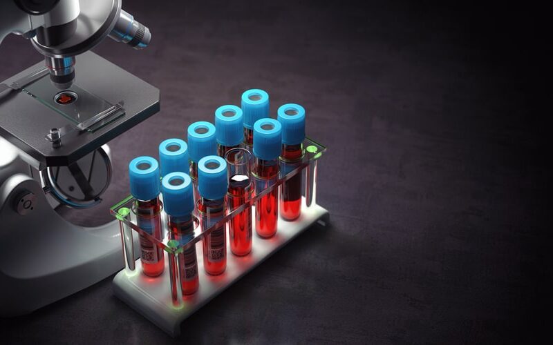 std testing laguna beach