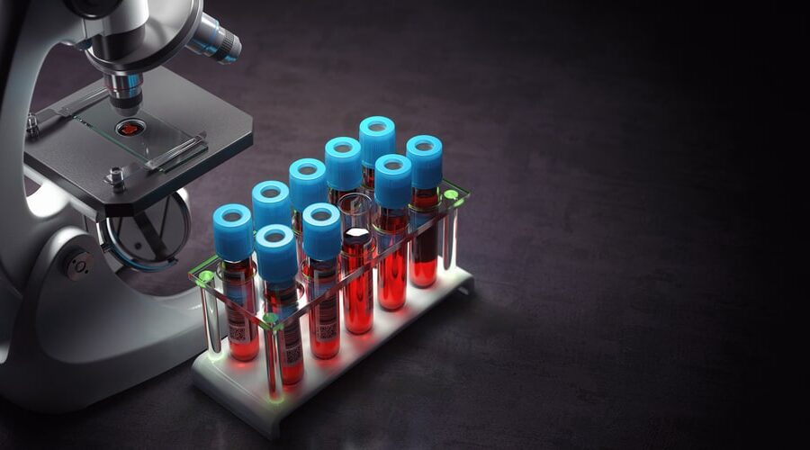 std testing laguna beach