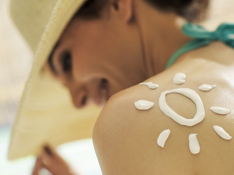 sunburn prevention