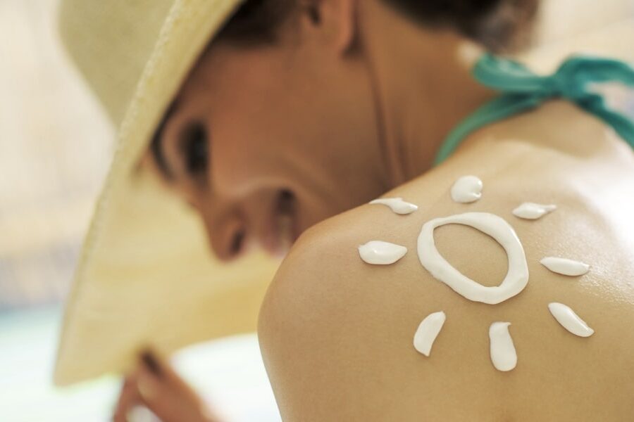 sunburn prevention