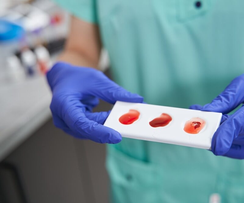 doctor doing blood typing