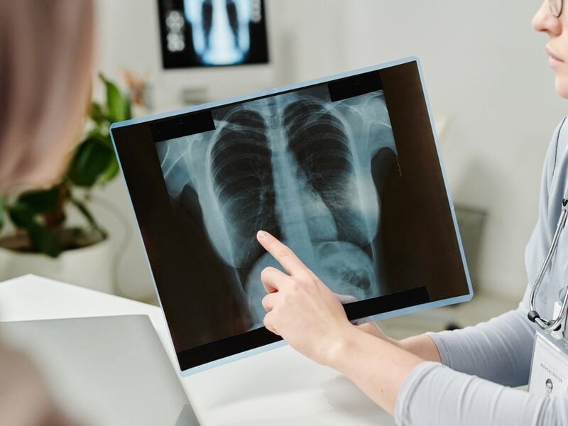 hand of young doctor pointing at chest x-ray image