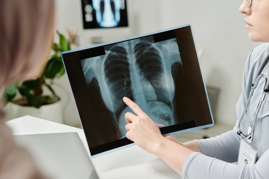 hand of young doctor pointing at chest x-ray image