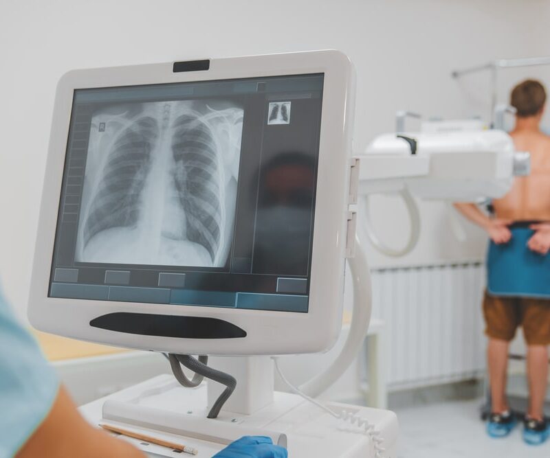 doctor using chest x-ray machine