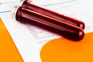 routine blood work​