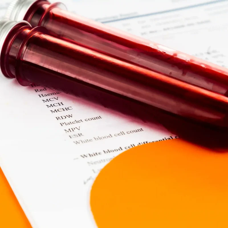 routine blood work​