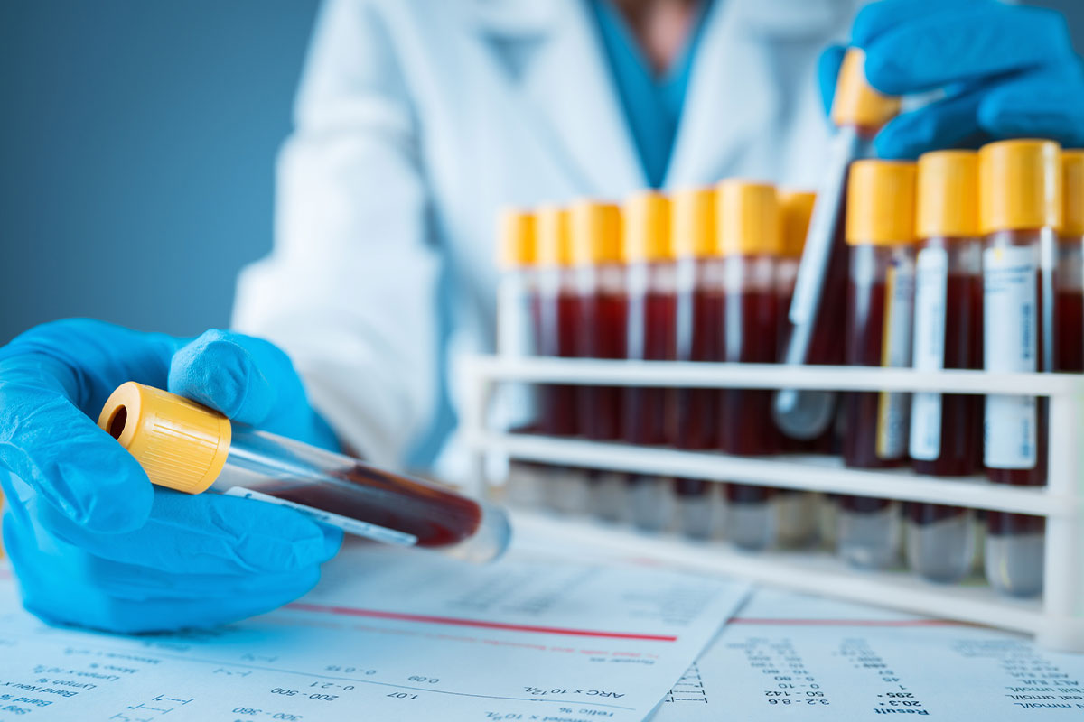 blood tests being done at Surfside Urgent Care in Laguna Beach.